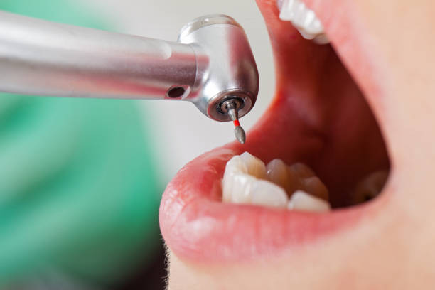 Best Emergency Pediatric Dental Care in Madill, OK